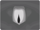 vocalCords5
